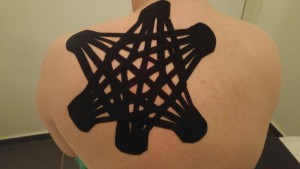 קינזיוטייפינג בהדבקת סטאר WEB