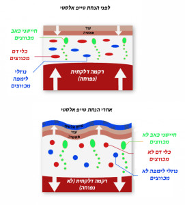 השפעת קינזיוטייפינג על רקמה מודלקת