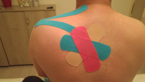 הדבקת קינזיוטייפינג "סטאר"