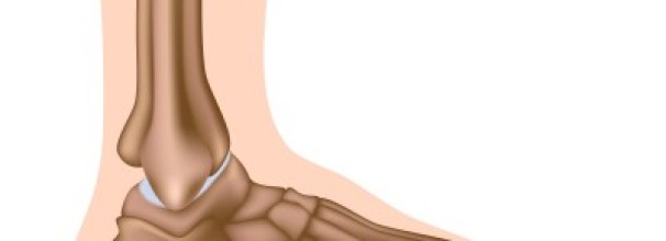 דורבן בעקב טיפול לדורבן