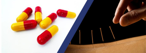 דיקור סיני או תרופות