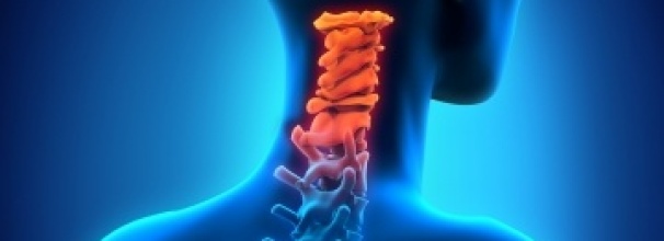 פריצת דיסק צווארי, בלט דיסק צווארי