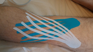 טיפול בדלקת בברך אחורית