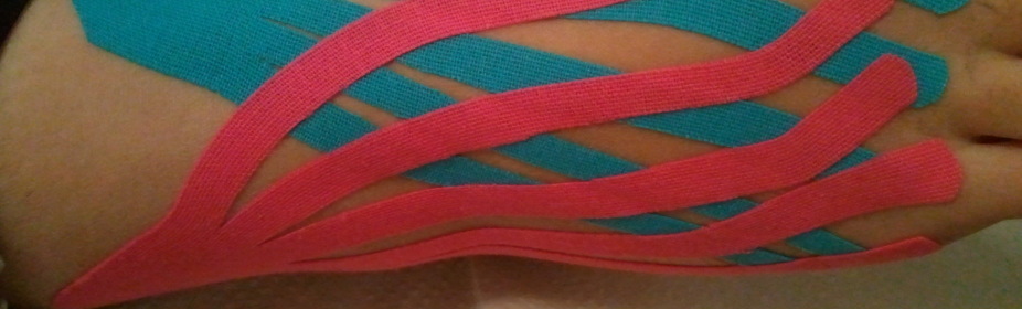 קינזיוטייפינג דלקת בקרסול