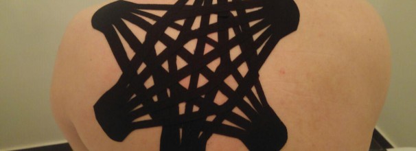 קינזיוטייפינג בהדבקת סטאר WEB