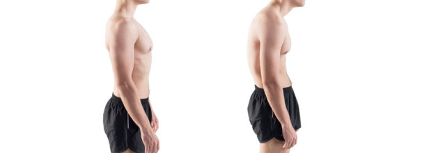 יציבה לקויה תגרום לכאבי גב